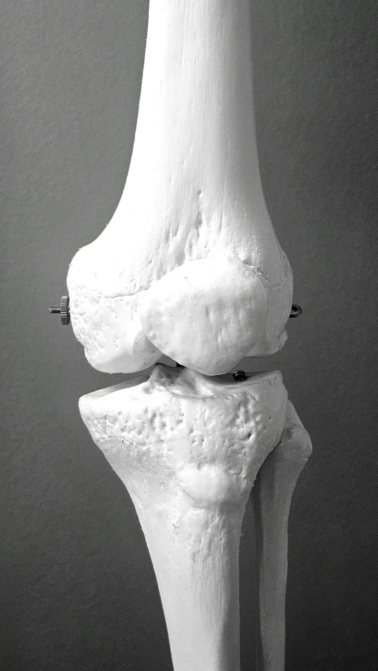 Protecting Cartilage: How Omega-3 Supports Joint Structure